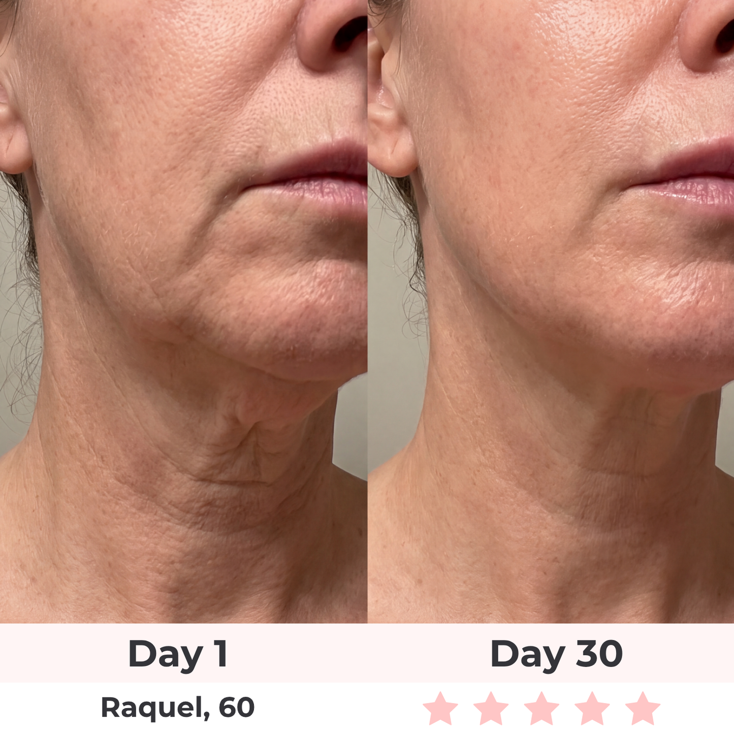 Brioderm 7-in-1 LED Facial Sculptor