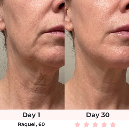 Brioderm 7-in-1 LED Facial Sculptor