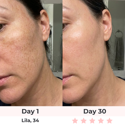 Brioderm 7-in-1 LED Facial Sculptor
