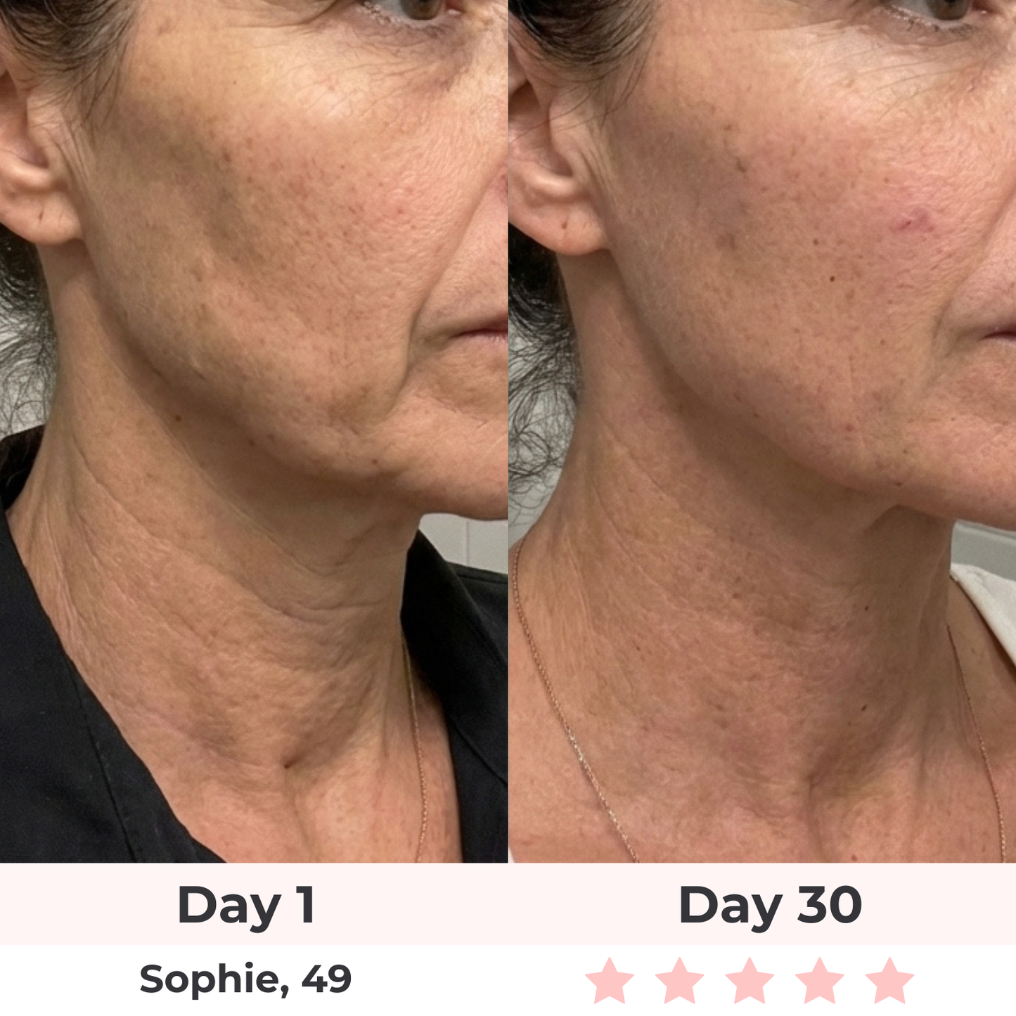 Brioderm 7-in-1 LED Facial Sculptor