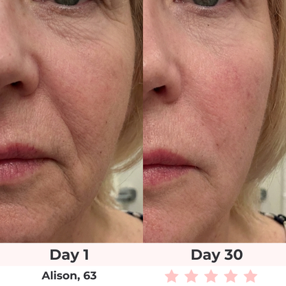 Brioderm 7-in-1 LED Facial Sculptor