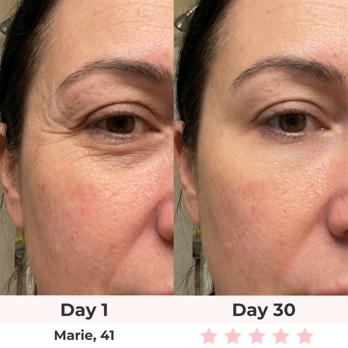 Brioderm 7-in-1 LED Facial Sculptor
