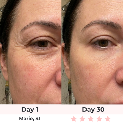 Brioderm 7-in-1 LED Facial Sculptor